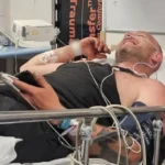 Adder Snake Bite Leaves Dad Hospitalized