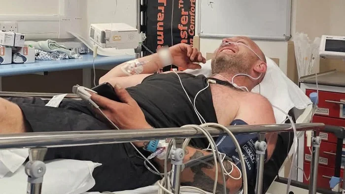 Adder Snake Bite Leaves Dad Hospitalized
